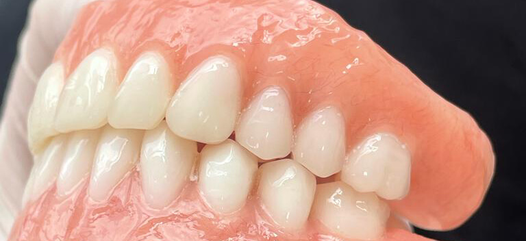 implantes dentales en Bogotá 